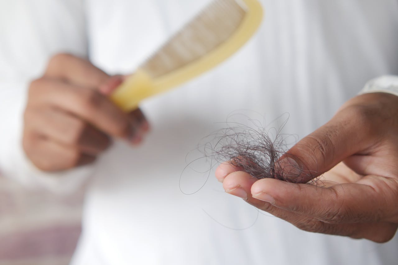 <p> While genetics plays a significant role in hair loss, it's a myth that it is the only factor contributing to this common concern. Various external factors can influence hair health, including stress, hormonal changes, medical conditions, and poor nutrition. For example, conditions such as thyroid disorders, anemia, and alopecia areata can lead to hair loss in individuals regardless of their genetic background. Additionally, lifestyle factors like diet and stress management can significantly impact hair health. If you're experiencing hair loss, consult a healthcare professional to identify potential underlying issues and explore treatment options. </p> :: Pexels